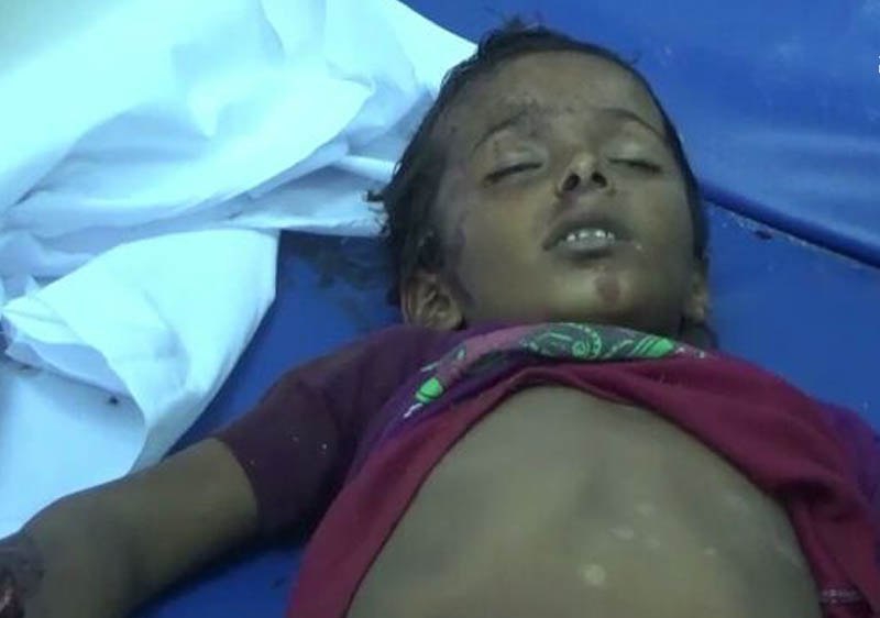 الحديدة: استشهاد 5 اطفال بعبوة ناسفة من مخلفات مليشيات الحوثي في الدريهمي